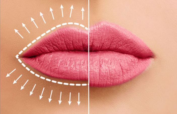 مرکز تزریق ژل لب