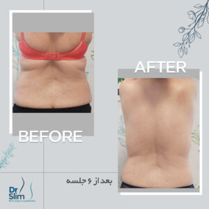 befor-after-1-300x300