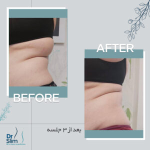 befor-after-10-300x300