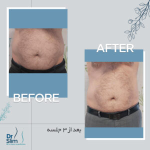 befor-after-11-300x300