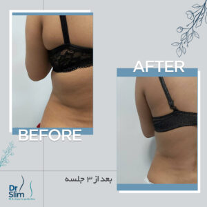 befor-after-12-300x300