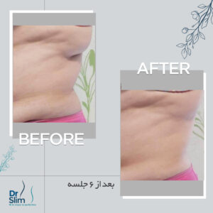 befor-after-2-300x300