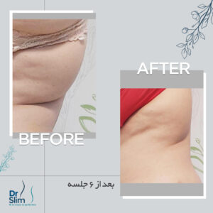 befor-after-3-300x300