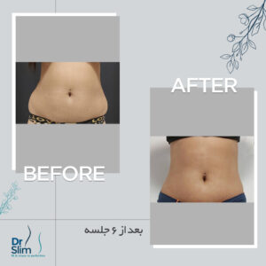 befor-after-5-300x300