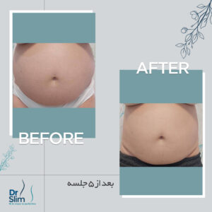 befor-after-6-300x300