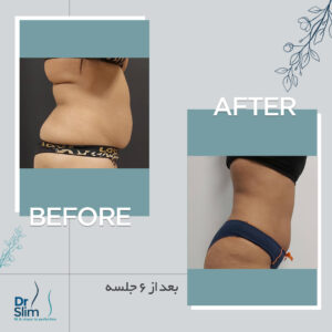 befor-after-7-300x300