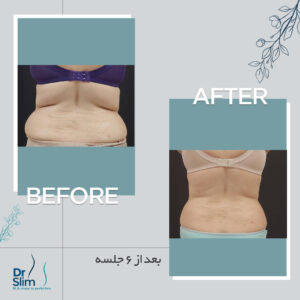 befor-after-8-300x300