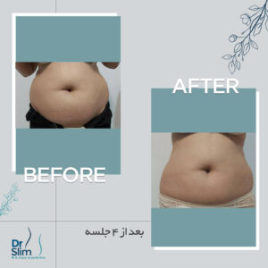 befor-after-9-300x300