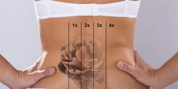 پاک کردن تاتو و خالکوبی