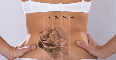 پاک کردن تاتو و خالکوبی