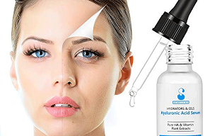 تزریق ژل هیالورونیک