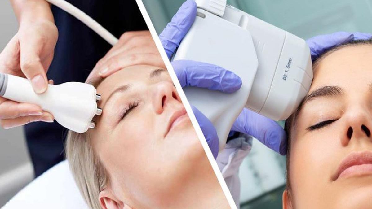 آر اف یا هایفو