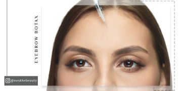 بوتاکس برای بالا بردن ابرو