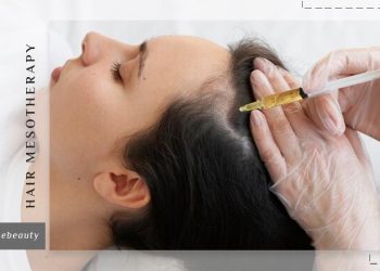 مزوتراپی مو