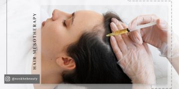 مزوتراپی مو