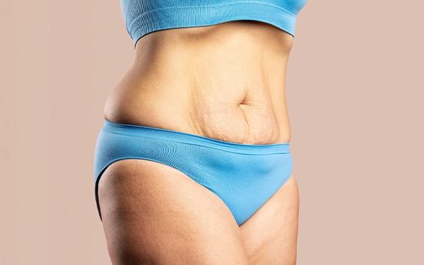 جلوگیری از شل شدن پوست در لاغری