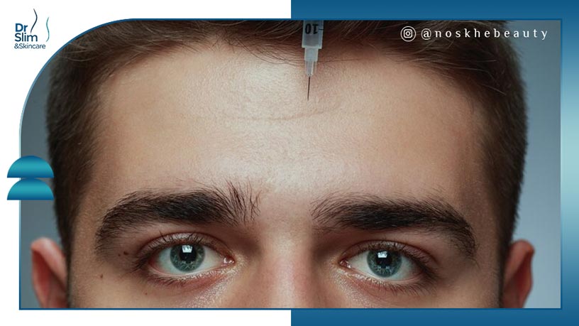 بوتاکس برای بالا بردن ابرو