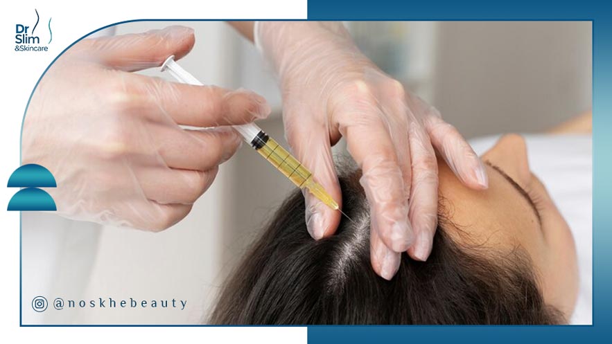 مزوتراپی مو