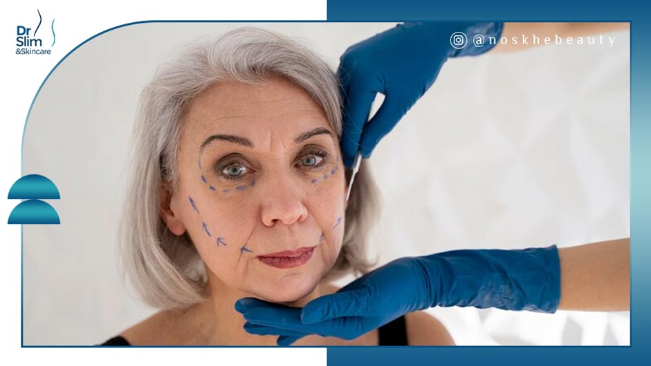 بوتاکس بهتر است یا لیفت با نخ