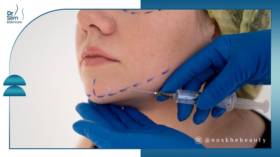 تزریق چربی به صورت چقدر ماندگاری دارد