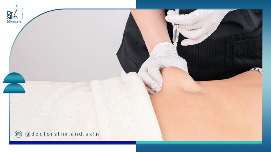 مزوتراپی لاغری