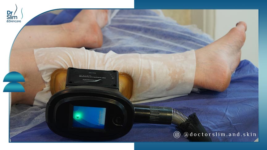 فریز کردن چربی