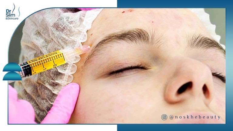 اگزوزوم سلول بنیادی برای درمان مشکلات پوست