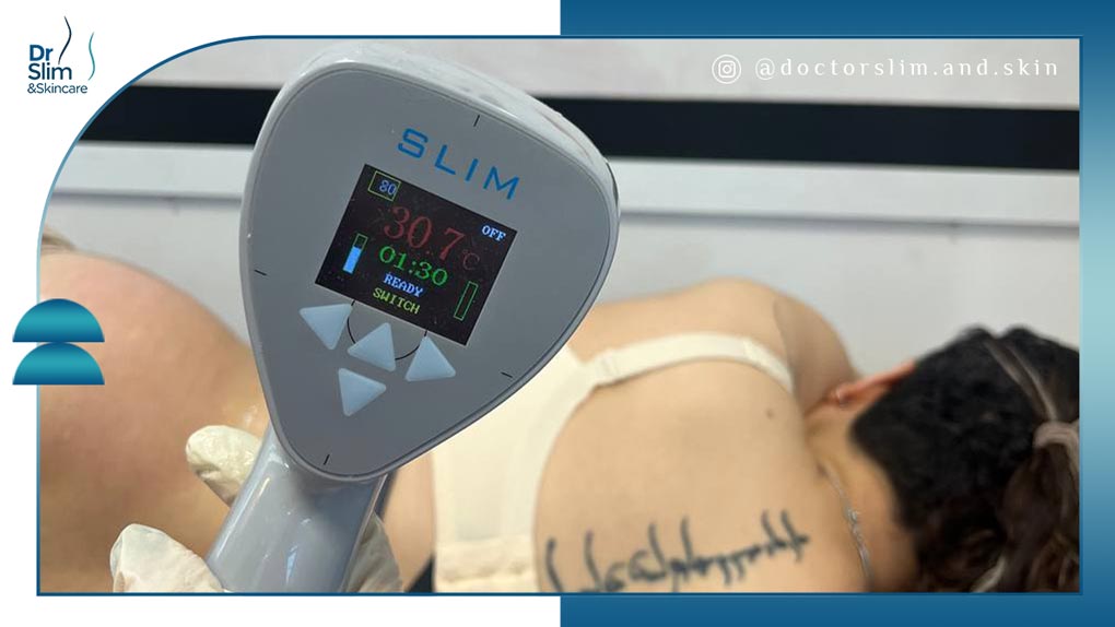 جدیدترین روش لاغری موضعی