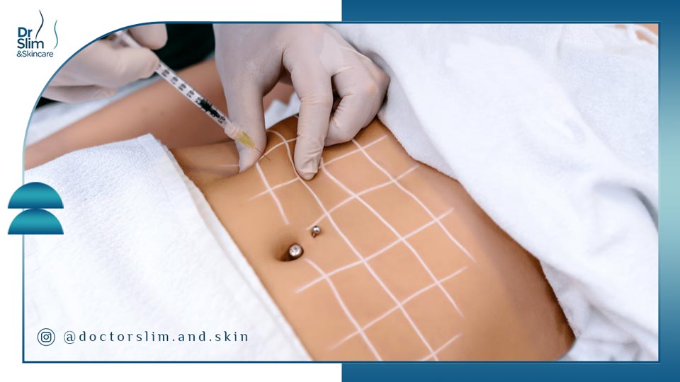 مزوتراپی لاغری