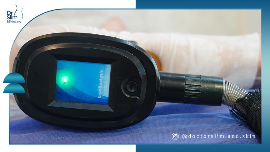 فریز کردن چربی