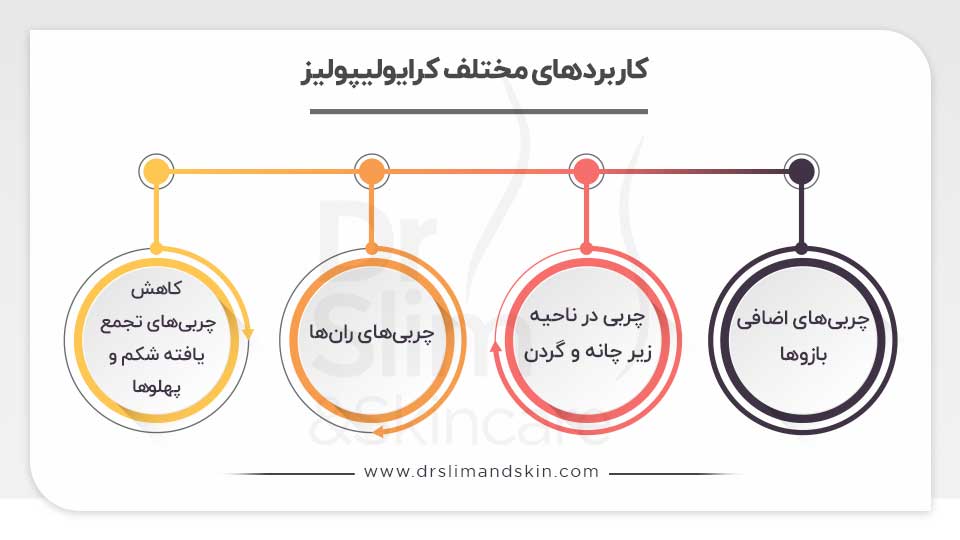 لاغری با دستگاه کرایولیپولیز