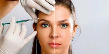 چروک پیشانی و روش‌های معجزه‌آسا برای از بین بردن آن