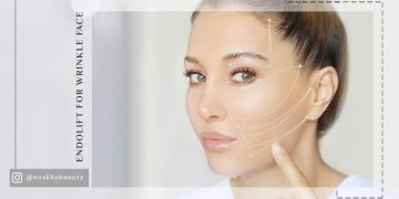 چرا باید از اندولیفت برای چروک‌های پیشانی استفاده کنیم