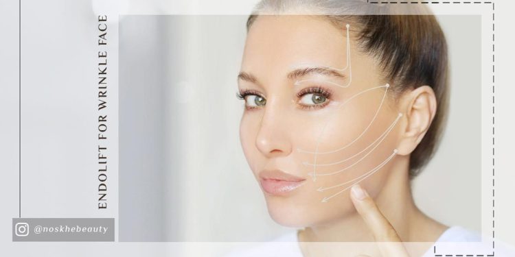 چرا باید از اندولیفت برای چروکهای پیشانی استفاده کنیم