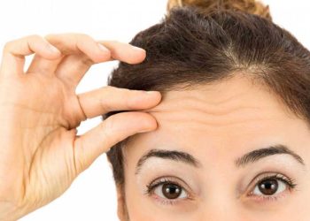 رفع چروک پیشانی با لیزر و بوتاکس