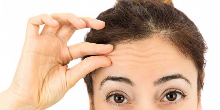 رفع چروک پیشانی با لیزر و بوتاکس