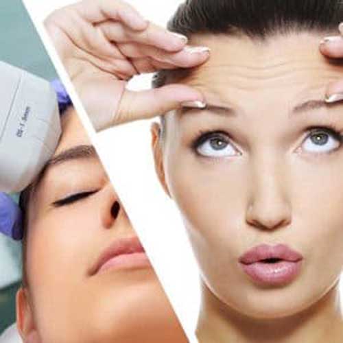 هایفوتراپی بهتر است یا بوتاکس