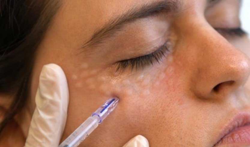 اگزوزوم زیر چشم چیست