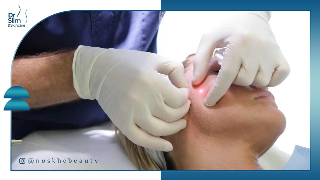 چرا باید از اندولیفت برای چروکهای پیشانی استفاده کنیم