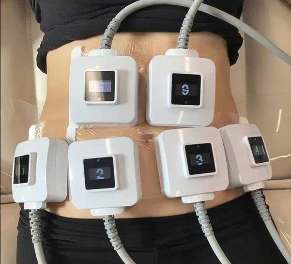 کاهش وزن آسان با دستگاه لاغری ترواسکالپ