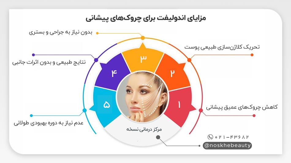 چرا باید از اندولیفت برای چروکهای پیشانی استفاده کنیم