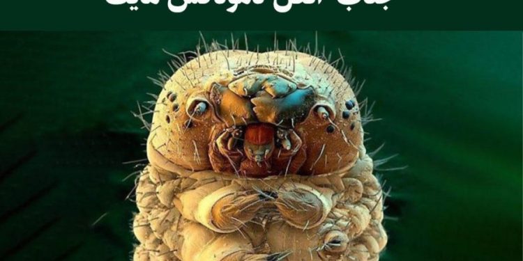 روغن درخت چای راهکار خانگی درمان دمودکس پوست سر