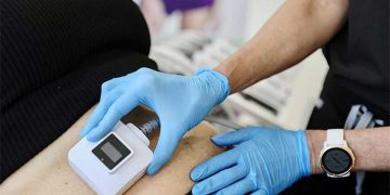 کاهش وزن با دستگاه ترواسکالپ یا اکسیلیس