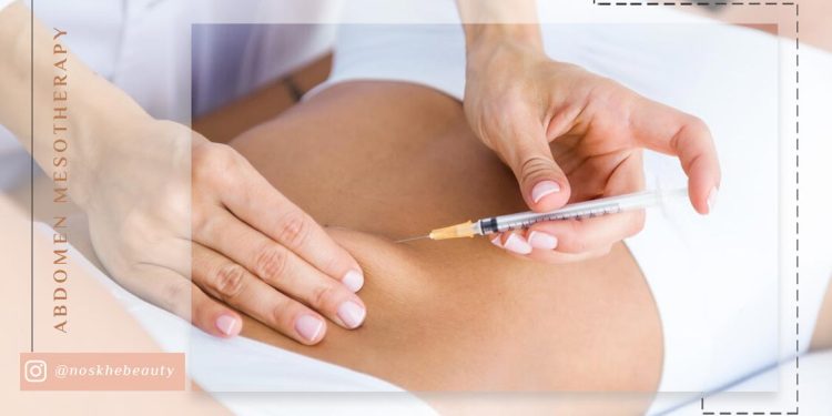 مزوتراپی شکم چیست و چقدر تاثیر دارد