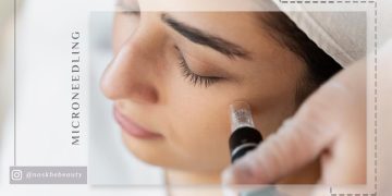 کلاژن‌ سازی با میکرونیدلینگ