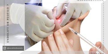 اندولیفت بهتر است یا پروفایلو