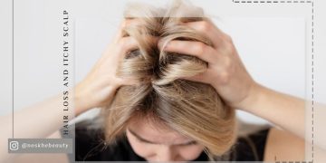 دلایل مهم ریزش مو و خارش سر انگل دمودکس را جدی بگیرید