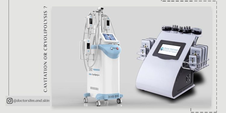 کویتیشن بهتر است یا کرایولیپولیز