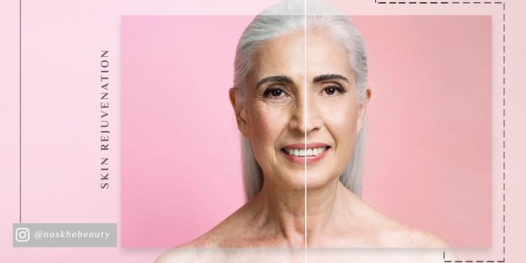 جوانسازی پوست