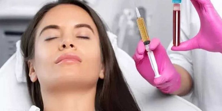 LPRP با پروفایلو روش جدید برای رفع چین و چروک صورت